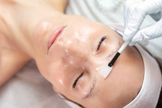 What are the benefits of a chemical peel